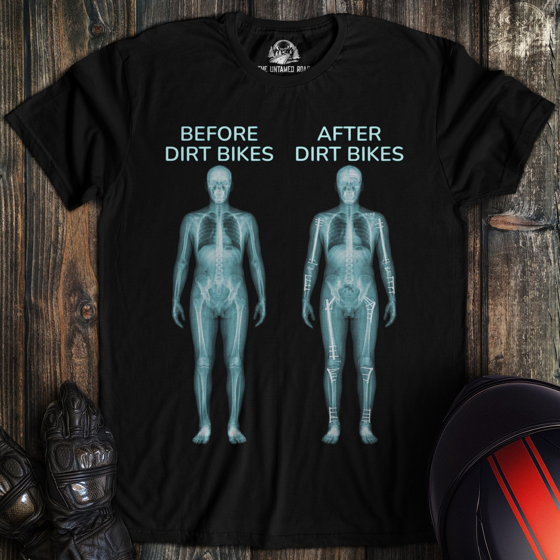 A black t-shirt featuring a funny biker graphic of two x-rays showing a human skeleton before and after dirt bikes.