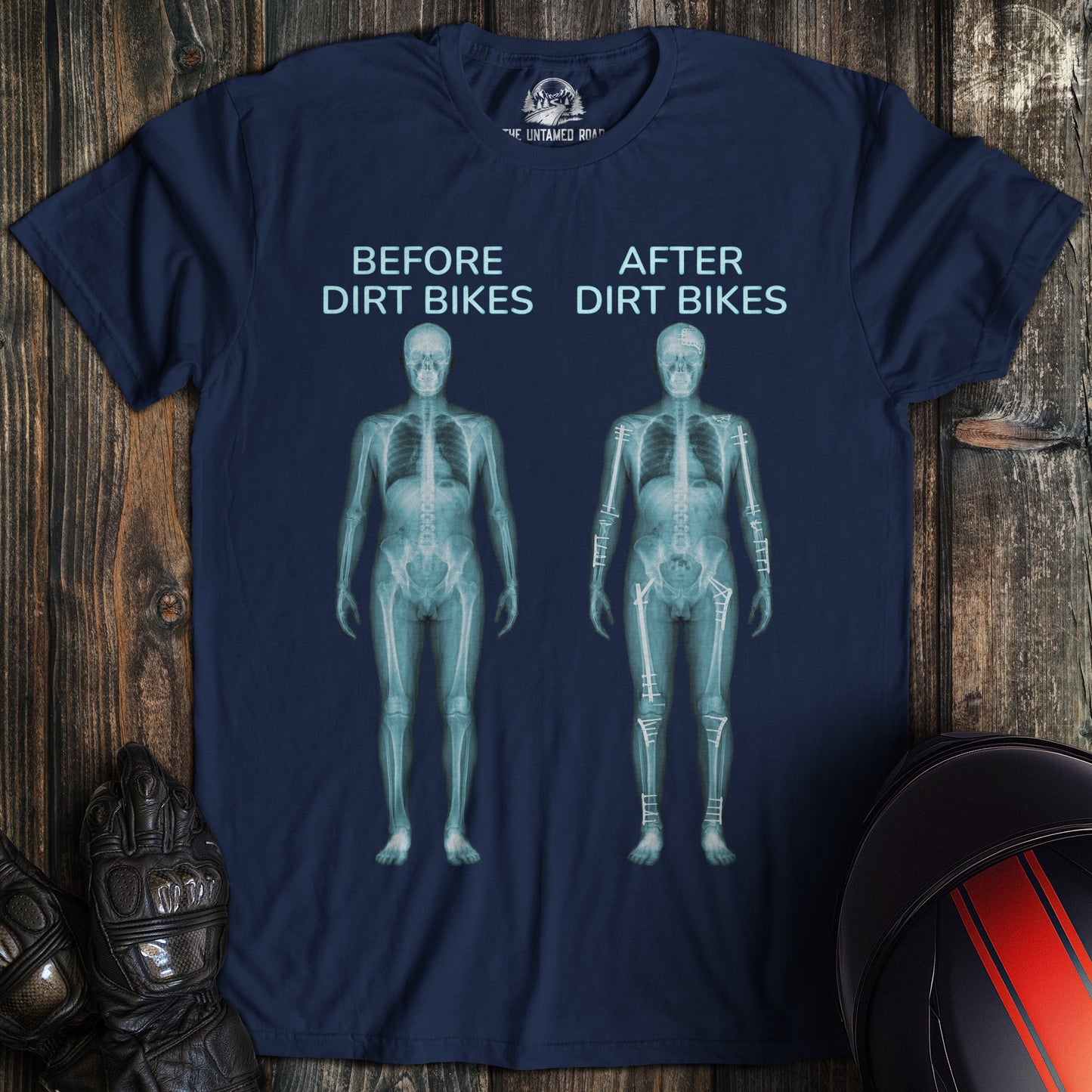 A navy blue t-shirt with a funny graphic showing a human x-ray before and after dirt bikes with surgical pins and plates.